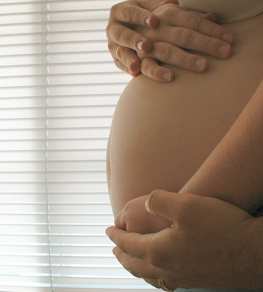 prevenir las estrías durante el embarazo